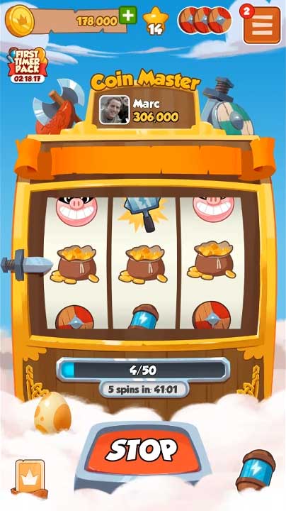 free spin and daily news coin master